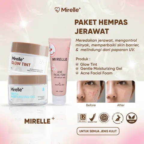 Mirelle - [Mirelle+] Paket Hempas Jerawat - Skincare untuk Kulit Berjerawat & Bruntusan